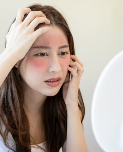 季節の変わり目に肌が荒れる原因とは?揺らぎ肌を繰り返さないためにの画像